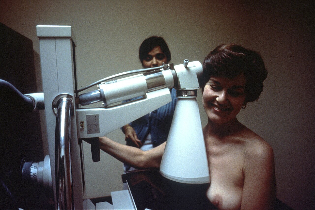 Mammographie